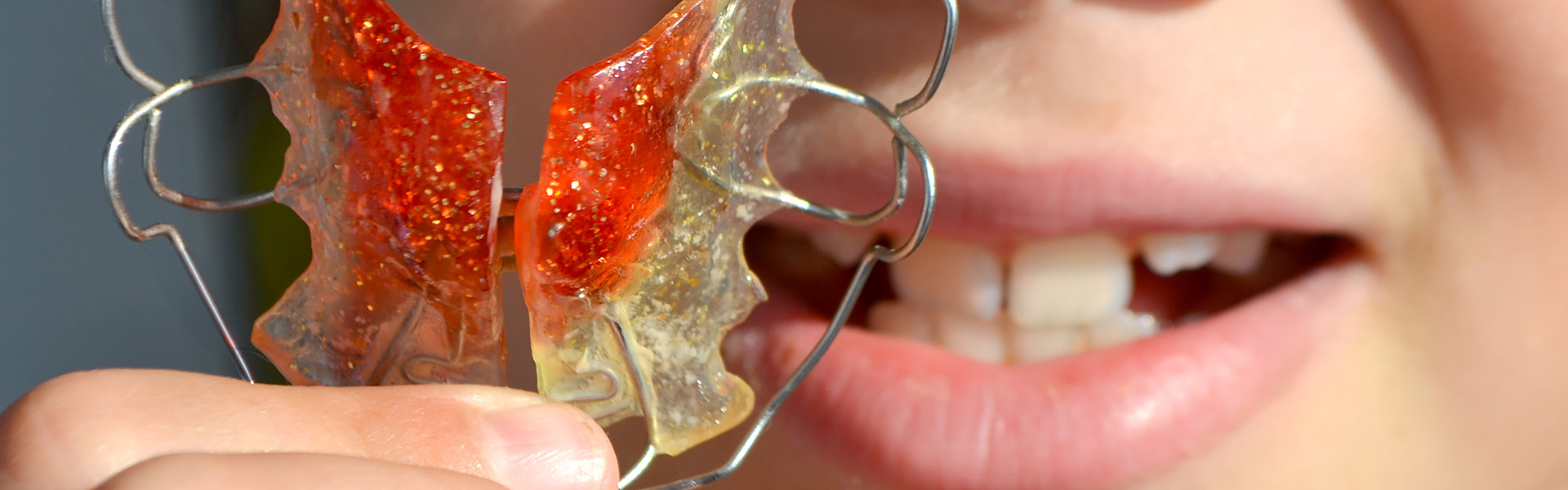 Kind mit einer glitzernden losen Zahnspange